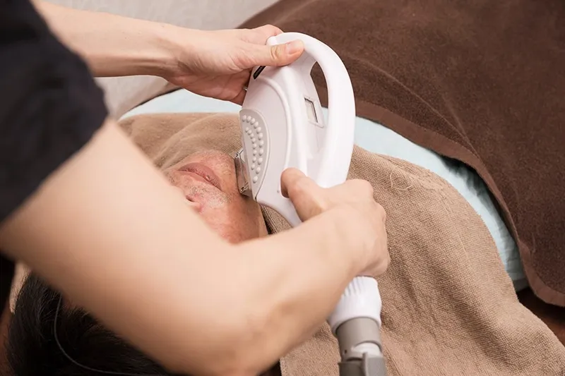 施術イメージ(脱毛)